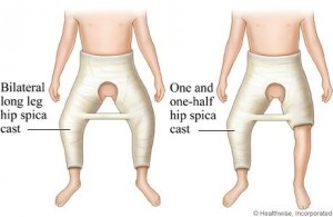 Micah's Cast